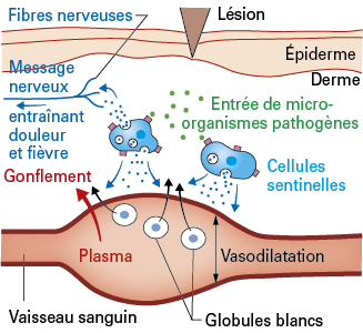 l'inflammation